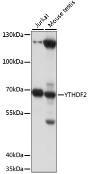YTHDF2 Polyclonal Antibody