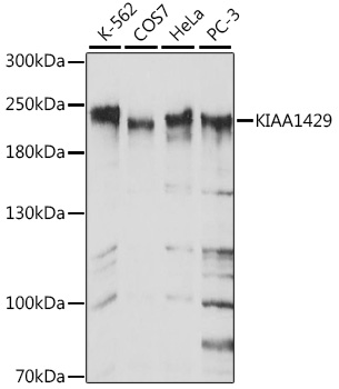 KIAA1429 Polyclonal Antibody