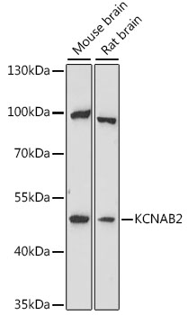 KCNAB2 Polyclonal Antibody