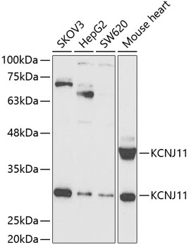 KCNJ11 Antibody
