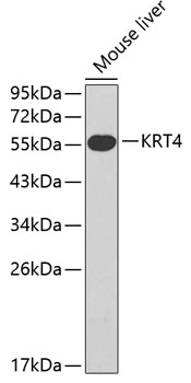 KRT4 antibody