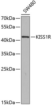 KISS1R antibody