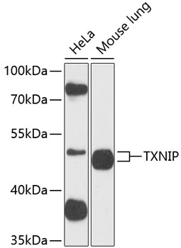 TXNIP Rabbit Polyclonal Antibody