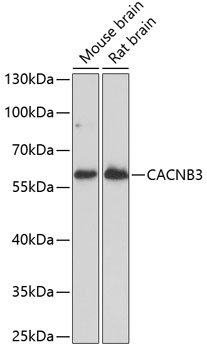 CACNB3 Rabbit Polyclonal Antibody