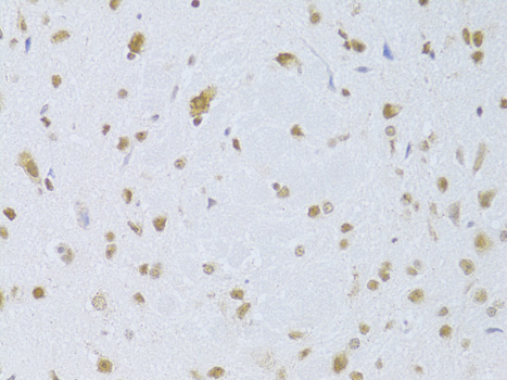 CDKN1A Rabbit Polyclonal Antibody - SAB | Signalway Antibody