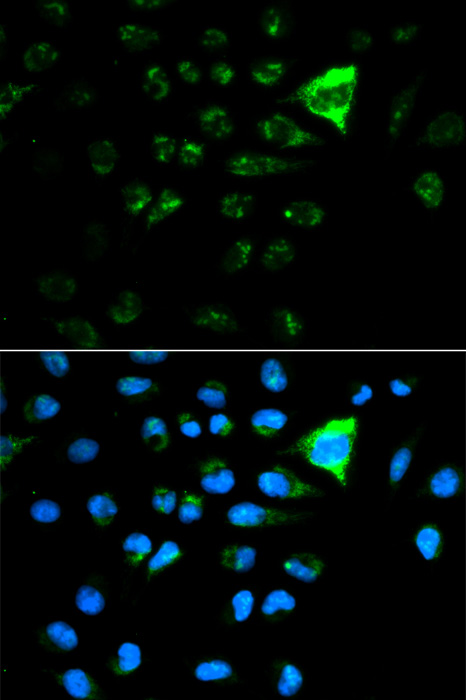 CDKN1A Rabbit Polyclonal Antibody - SAB | Signalway Antibody