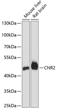 CNR2 Rabbit Polyclonal Antibody