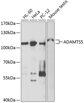ADAMTS5 Rabbit Polyclonal Antibody