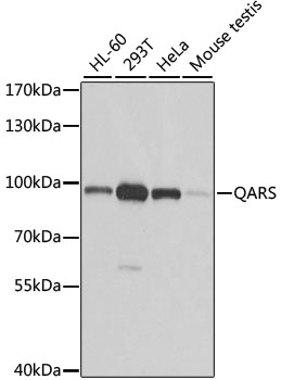 QARS Rabbit Polyclonal Antibody