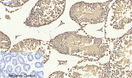 p53(Ab-15) Antibody