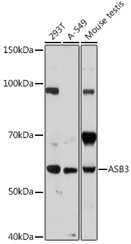 ASB3 Rabbit Polyclonal Antibody - SAB | Signalway Antibody
