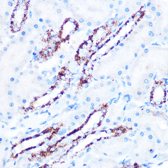 ASB3 Rabbit Polyclonal Antibody - SAB | Signalway Antibody