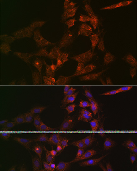 ASB3 Rabbit Polyclonal Antibody - SAB | Signalway Antibody