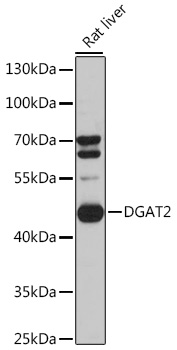 DGAT2 Polyclonal Antibody