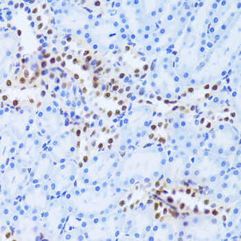 ANP32A Antibody - SAB | Signalway Antibody