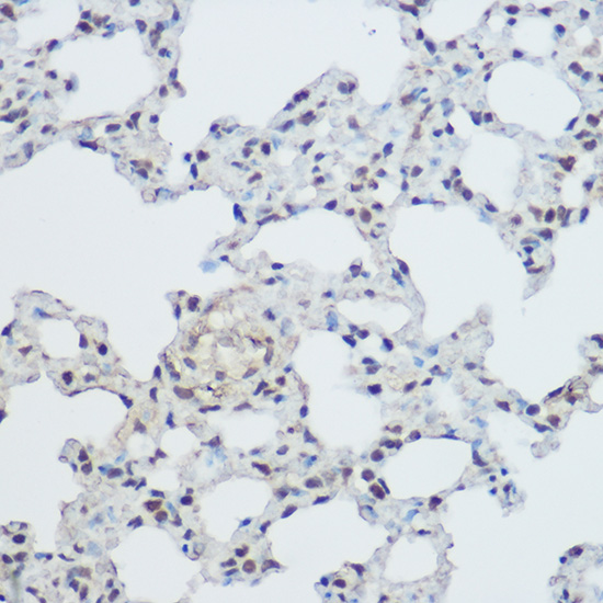 XRCC1 Rabbit Polyclonal Antibody
