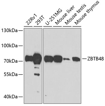 ZBTB48 Rabbit Polyclonal Antibody
