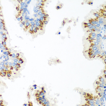 UBIAD1 Rabbit Polyclonal Antibody