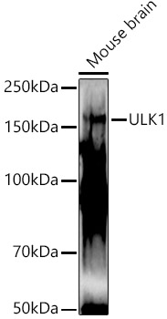 ULk1 Rabbit Polyclonal Antibody