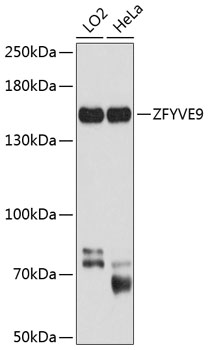 ZFYVE9 Rabbit Polyclonal Antibody