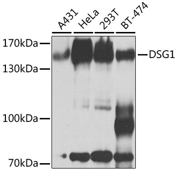 DSG1 Rabbit Polyclonal Antibody