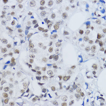 Histone H3K79me2 Polyclonal Antibody