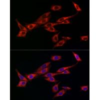 OPA1 Rabbit Polyclonal Antibody