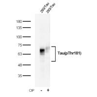 Recombinant Tau(Phospho-Thr181) Rabbit mAb(G69) 