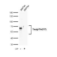 Recombinant Tau(Phospho-Thr217) Rabbit mAb(G122)