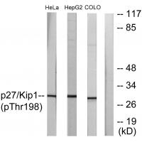 p27 Kip1 (Phospho-Thr198) Antibody