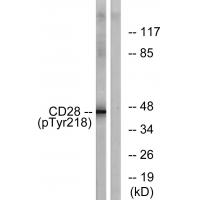 CD28 (Phospho-Tyr218) Antibody
