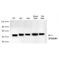 β-Tubulin Rabbit mAb