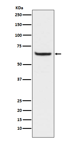 NF-κB p65 (Phospho-Ser529) Rabbit mAb