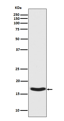 alpha Synuclein (Phospho-Ser129) Rabbit mAb