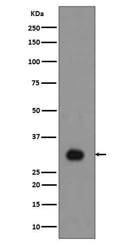 Histone H1.4 (Phospho-Thr17) Rabbit mAb