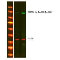 PDGFRb (Phospho-Tyr579+Tyr581) Antibody