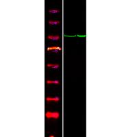 CTNND1 (Phospho-Tyr257) Antibody
