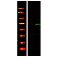 FKHRL1 (Phospho-Ser321) Antibody