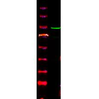BTK (Phospho-Ser179) Antibody