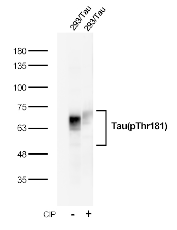 Recombinant Tau(Phospho-Thr181) Rabbit mAb(G69) 