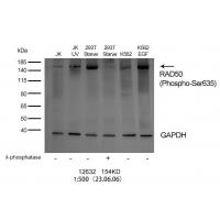 RAD50 (Phospho-Ser635) Antibody