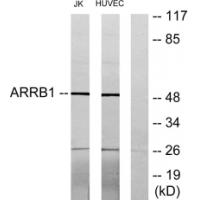 Arrestin-β-1 Polyclonal Antibody