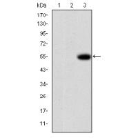 MMP-9 Monoclonal Antibody