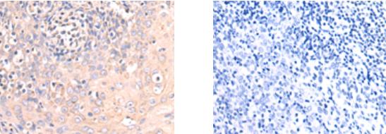 Ctsc Localization CTSC Antibody - SAB | Signalway Antibody