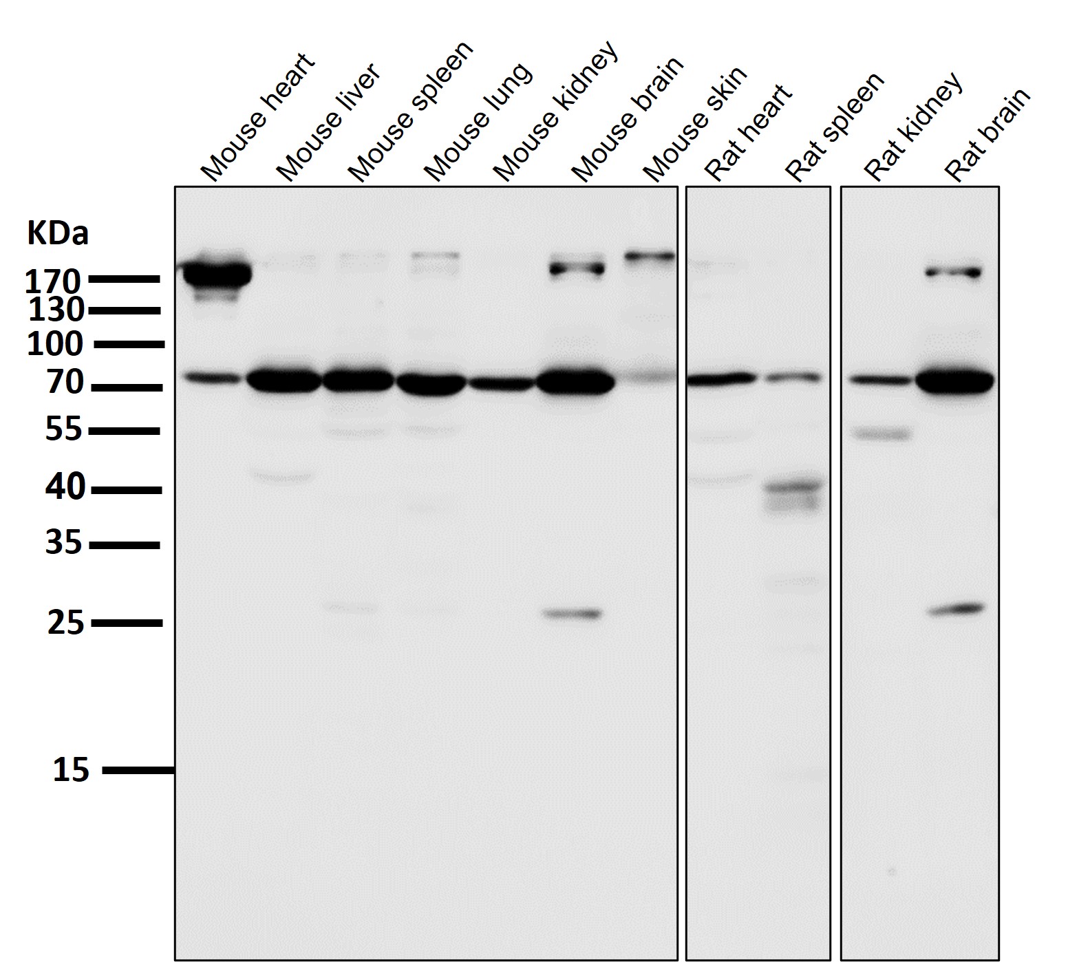 All lanes use the Antibody at 1:2K dilution for 1 hour at room temperature.