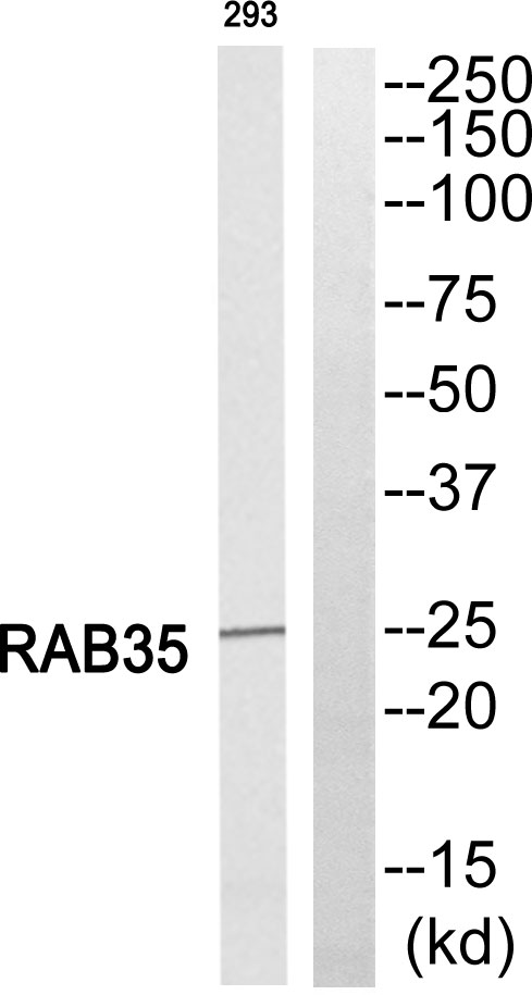 Pab Rabs Rab 35 Rabbit pAb - SAB | Signalway Antibody
